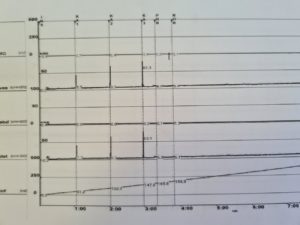cystometricke-vysetreni
