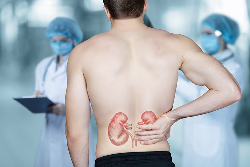 Nemocný muž chytající se za ledviny před týmem doktorů
